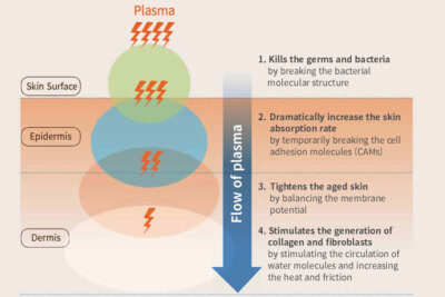 Fractional plasma and fractional laser difference