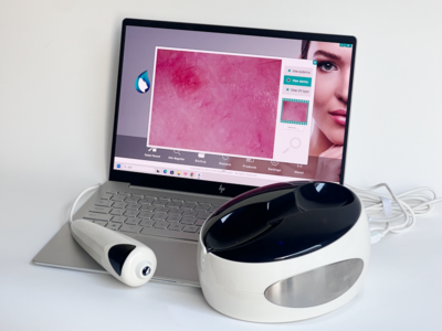 skin and body analyzer also giving body health report