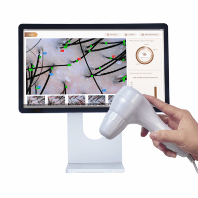 AI hair analyzer scalp diagnostic analysis hair follicle