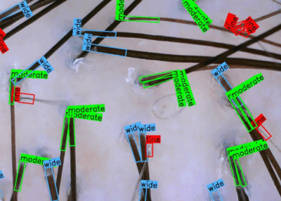 AI hair analyzer test item and application